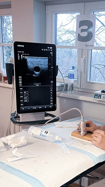 SZKOLENIE ULTRASONOGRAFIA W STANACH NAGŁYCH