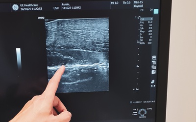 SZKOLENIE ULTRASONOGRAFIA W STANACH NAGŁYCH