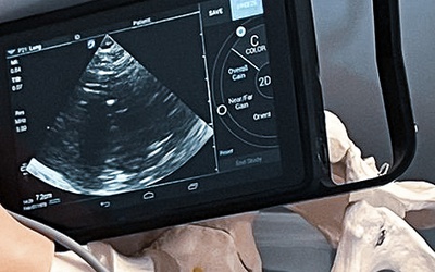 SZKOLENIE ULTRASONOGRAFIA W STANACH NAGŁYCH