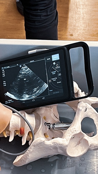 SZKOLENIE ULTRASONOGRAFIA W STANACH NAGŁYCH