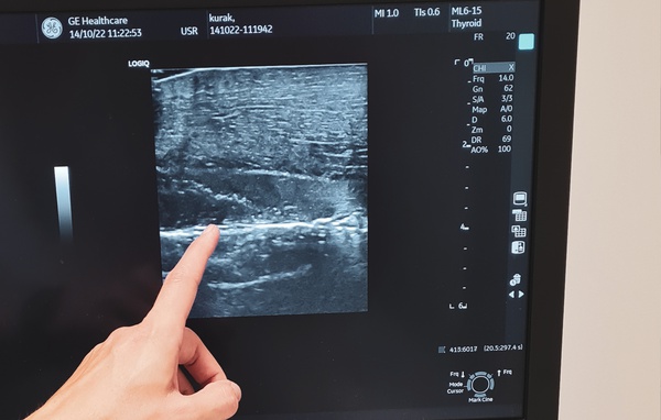 SZKOLENIE ULTRASONOGRAFIA W STANACH NAGŁYCH