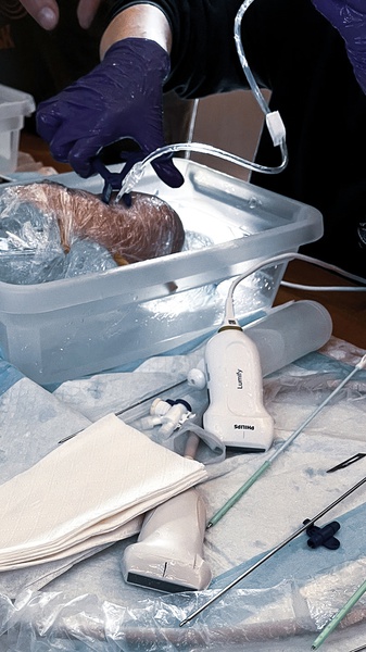 PROCEDURY INTERWENCYJNE POD KONTROLĄ USG