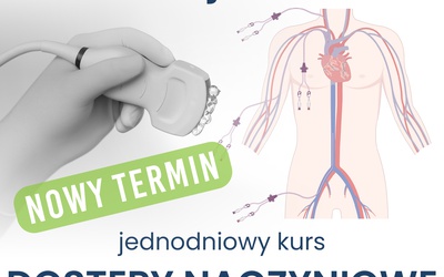 DOSTĘPY NACZYNIOWE POD KONTROLĄ USG