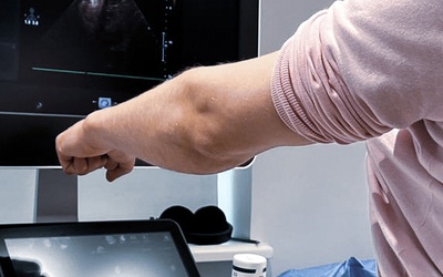 PROCEDURY INTERWENCYJNE POD KONTROLĄ USG