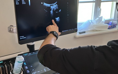 ULTRASONOGRAFIA ŻYŁ KOŃCZYN DOLNYCH